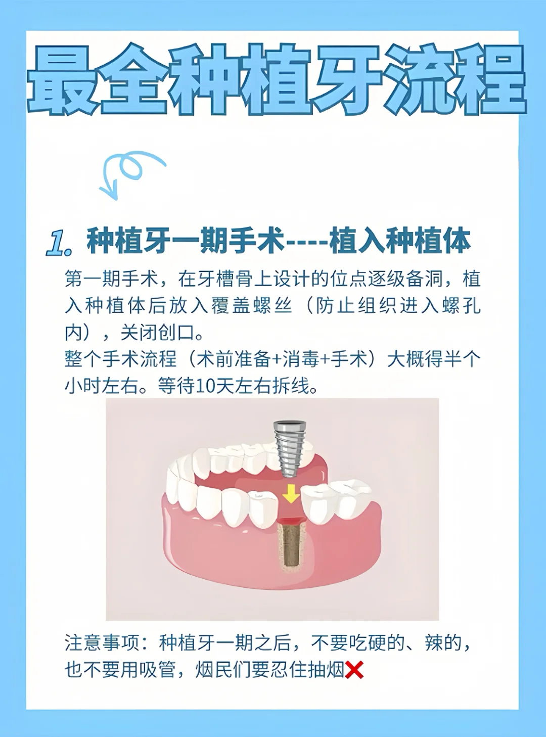 不会还有人不知道种植牙流程吧（干货版）,代孕成功率如何