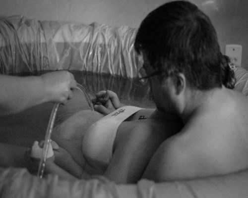 代怀公司有哪些_代怀详细资料,卵泡萎缩必须做试管婴儿吗_卵泡萎缩还能受孕吗