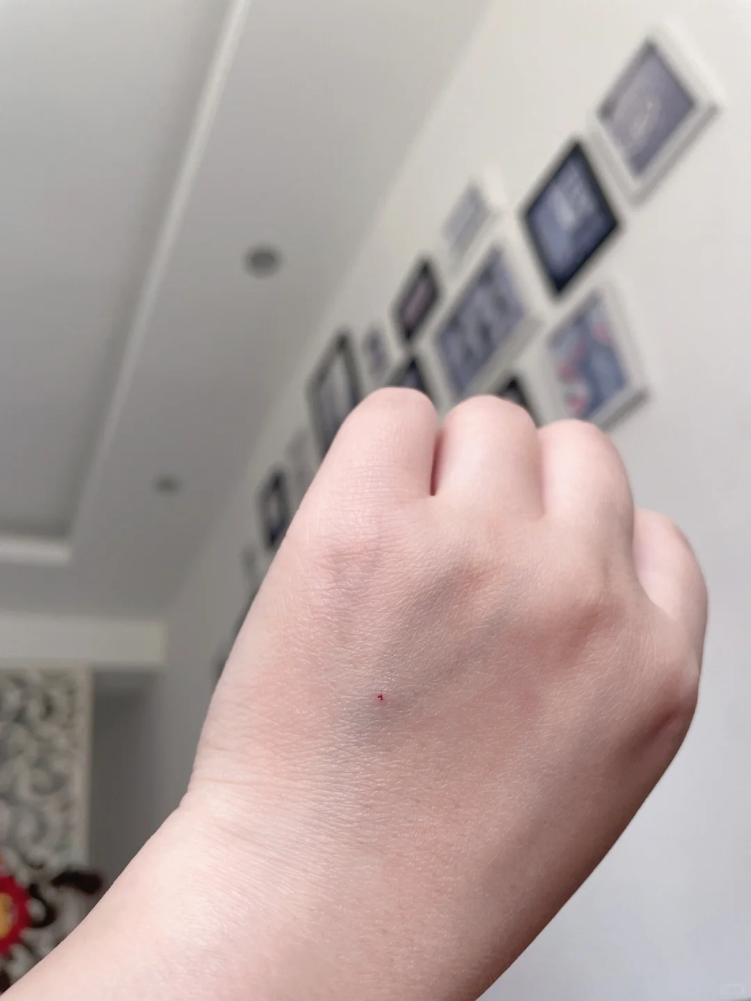 取卵结束🔚就取了8个是不是有点少？加油吧