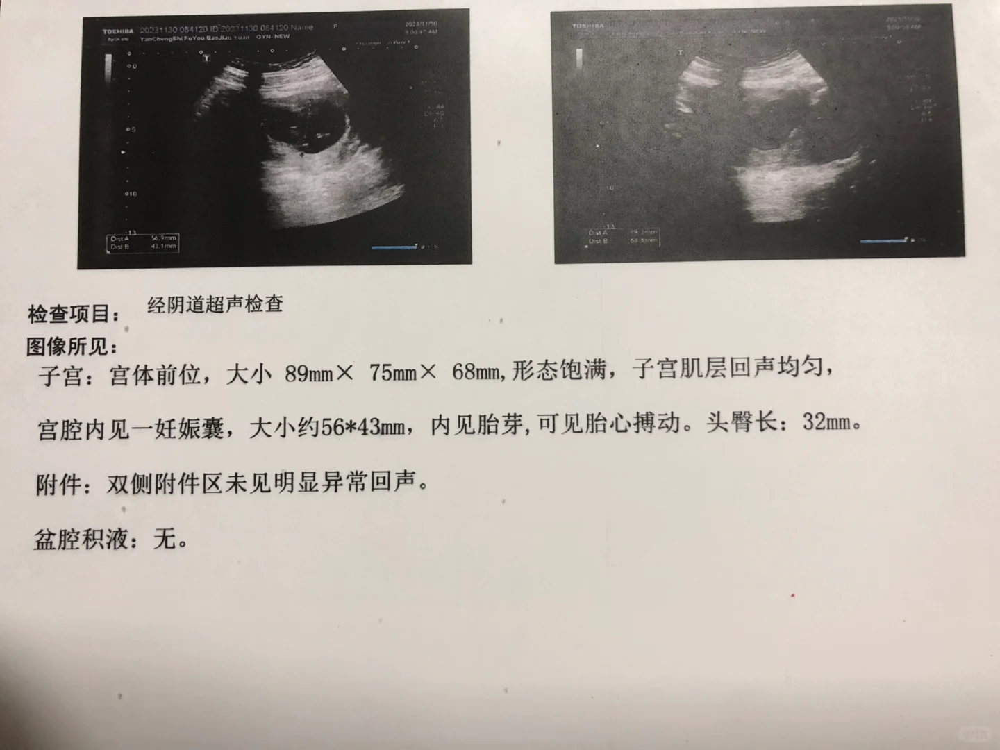 一促二移生殖科毕业,靠谱供卵代孕