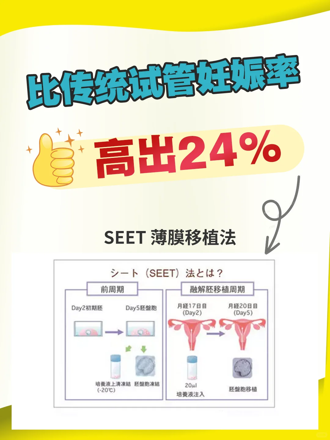 试管攻略｜SEET禾多植法成功怀孕的几率达80%